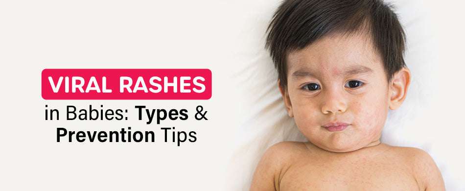 Viral Rashes in Babies: Types & Prevention Tips